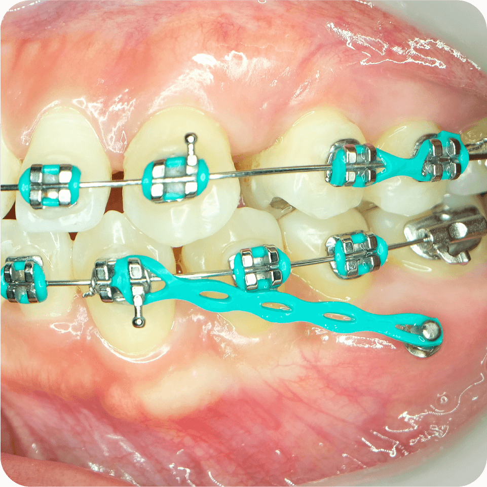 Dentist high-fiving patient